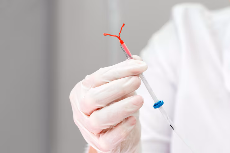 IUD Insertion and Removal at CUPA Ortho and Women’s Care